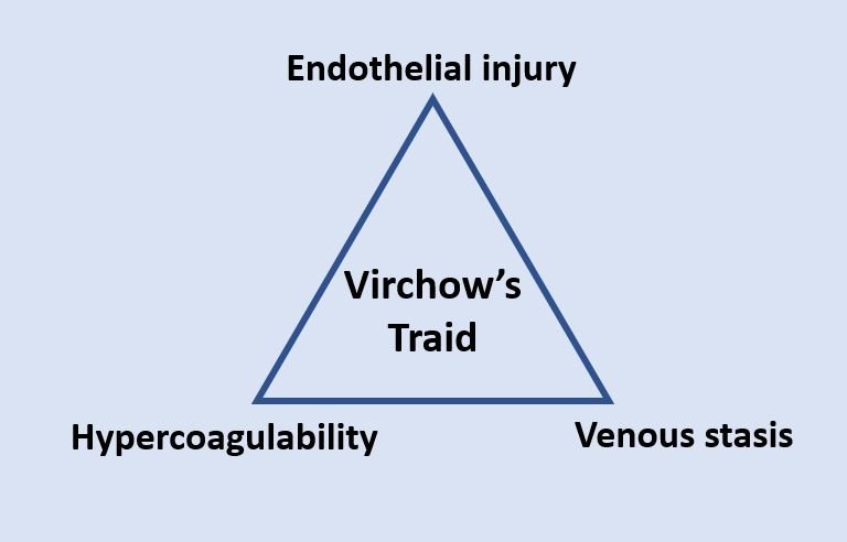 Diagram of Virchow’s triad: stasis, endothelial injury, hypercoagulability.