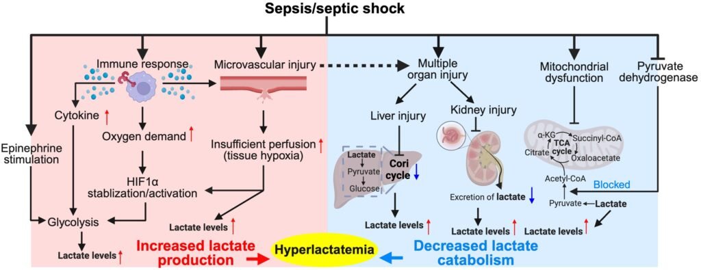sepsis_lactate explanation of lactate increase in septic shock